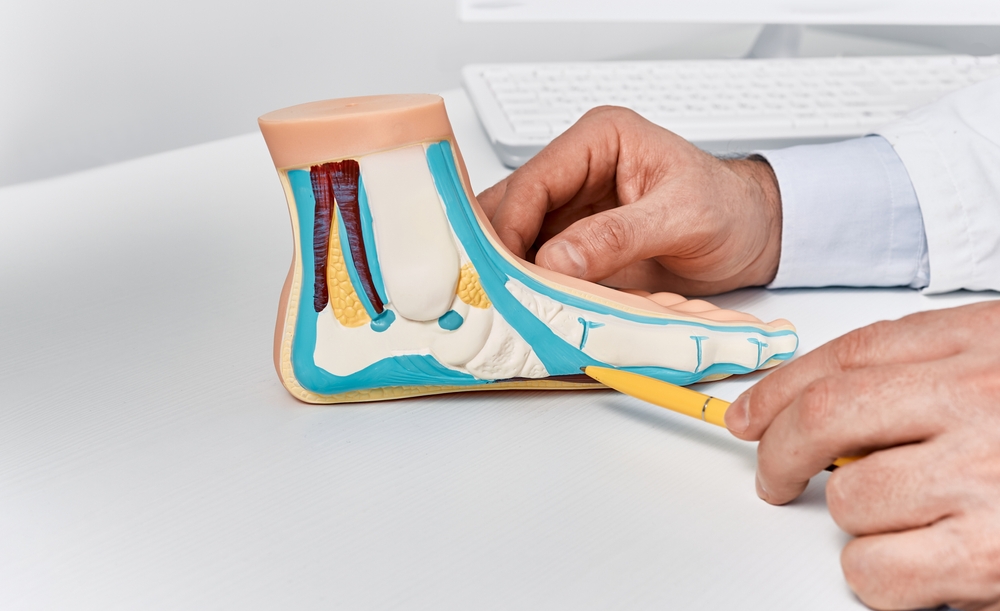 Anatomical flat foot model on doctor table while consultation in orthopedics center.